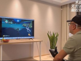 我国成功开展首例侵入式脑机接口临床试验